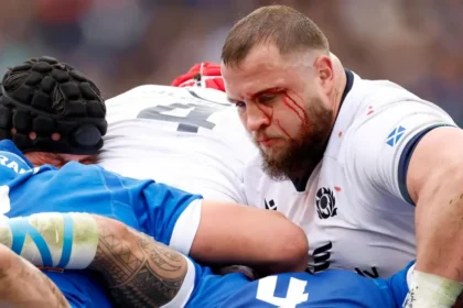 Uncage the Gorilla: Schoeman on What Scotland Must Improve Before the Six Nations