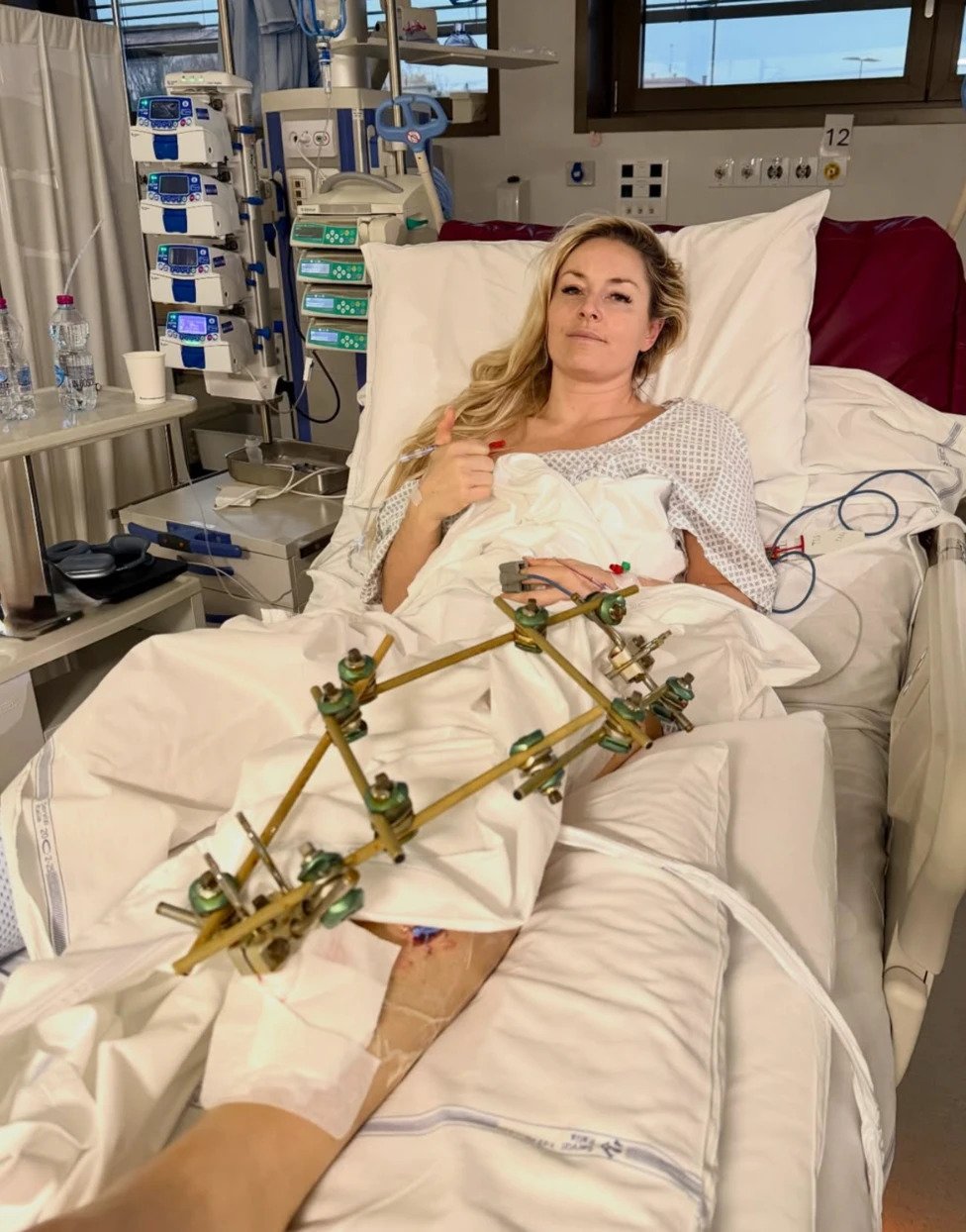 Lindsey Vonn Making Progress After Third Leg Surgery