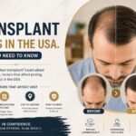 hair transplant