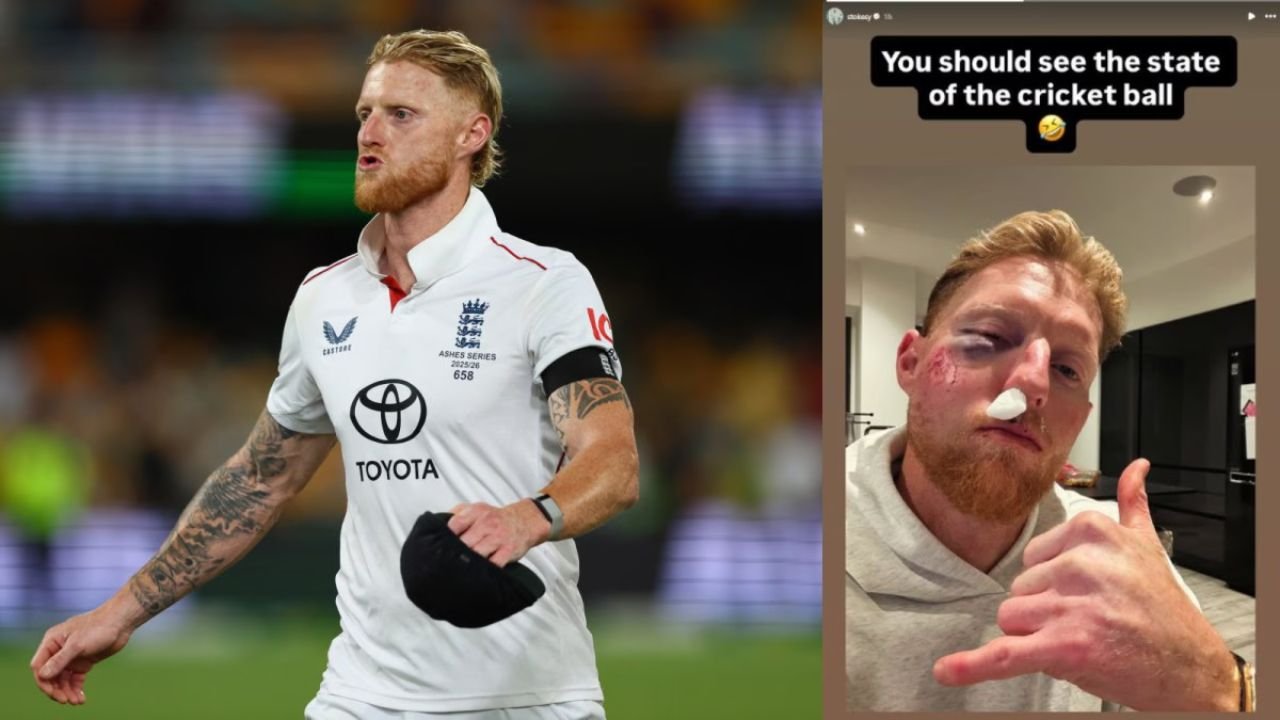 Ben Stokes Injury Update