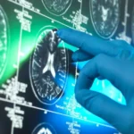 Alzheimer’s Drugs May Offer Limited Patient Benefit, New Analysis Finds High Cost and Limited Access Raise Questions A new independent analysis has found that so called breakthrough Alzheimer’s drugs are unlikely to deliver meaningful benefits for most patients. Researchers say the impact remains far below what is needed to improve daily life for people living with dementia. These drugs are approved in several countries. However, they are not funded by the NHS in the UK. Private treatment can cost around £90,000 for an 18 month course, making them unaffordable for most patients. How the Drugs Work The treatment targets a sticky substance called beta amyloid. This protein builds up between brain cells in Alzheimer’s disease and is linked to memory loss and cognitive decline. Scientists designed antibodies to identify and remove this protein from the brain. These antibodies work in a similar way to natural immune defenses that fight infections. Mixed Results From Clinical Trials Early attempts to remove amyloid failed to show results. More recent trials involving donanemab and lecanemab showed a small slowing of cognitive decline. Researchers described this as an important scientific step. It was the first time any treatment had shown an ability to slow brain deterioration in Alzheimer’s disease. Large Review Finds Limited Benefit The Cochrane Collaboration reviewed data from 17 studies involving more than 20,000 participants. The review found that amyloid removing drugs do slow the disease. However, the improvement was too small to make a noticeable difference in patients’ everyday lives. Safety Risks and Treatment Burden The drugs are also linked to serious side effects. Some patients experienced brain swelling and bleeding during treatment. In addition, the therapy requires regular infusions every two to four weeks. This creates a long term treatment burden for patients and healthcare systems. Scientific Debate Continues The findings have triggered disagreement among scientists. Some researchers believe the drugs represent real progress in treating Alzheimer’s disease. Others argue the clinical benefits are too small to justify widespread use.