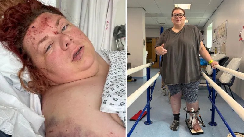 Woman survives 330ft mountain crash after phone alert triggers emergency rescue Sudden loss of control on Horseshoe Pass Natalia Sidorska, 32, was driving alone on Horseshoe Pass in Denbighshire late in June 2025 when her car went out of control on a sharp bend. She was unfamiliar with the road and admitted she may have been driving too fast for the 40mph limit. The car left the road and fell down a steep mountainside, dropping more than 100m, which is around 330ft. Car rolls down steep slope and catches fire The vehicle rolled repeatedly down the slope before coming to rest in a field. Natalia remembers the moments clearly as the car tumbled and airbags deployed during impact. When the car stopped, she found herself trapped and injured. She struggled to understand what had happened and soon heard the sound of fire starting inside the vehicle. The fire spread quickly, leaving her very little time to react. Escape under extreme conditions Natalia tried to open the doors but could not move properly due to injuries to her leg. She was still inside the burning car and had to act quickly to survive. She managed to get herself out moments before the vehicle became fully engulfed. Phone crash detection alert triggered rescue response Her iPhone automatically detected the crash using built in sensors. The device sent an alert to emergency services and shared her location details. Rescue teams were alerted quickly and were able to respond to the remote location. Mountain rescue teams later estimated the fall distance at over 100m. Natalia later said the phone alert likely played a major role in ensuring help arrived in time. Recovery and reflection after the crash She spent four months in hospital recovering from her injuries. She described the aftermath as more difficult than the crash itself. She often drove alone to clear her mind before the incident. On this trip, it was her first time driving along that road.