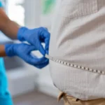 Obesity cases rising fastest among young adults in England, study finds